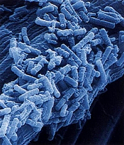 Bacillus stearothermophilus